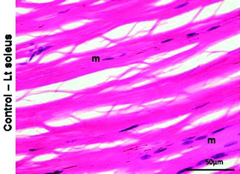 Light microscopic picture of L.S of skeletal muscle fiber of uncrushed ...