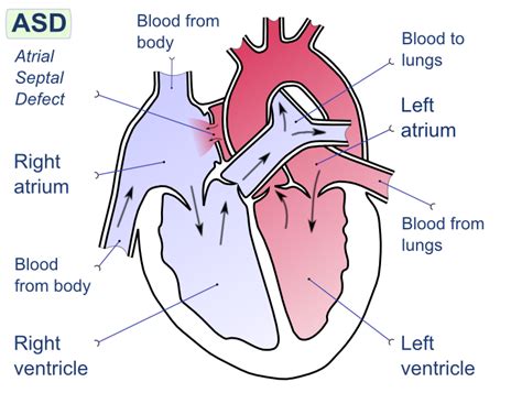 Cardiac Shunt Study