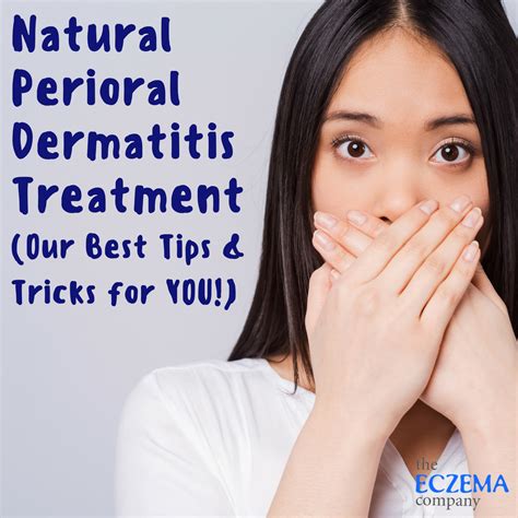 Natural Perioral Dermatitis Treatment (Our Best Tips & Tricks for YOU!)