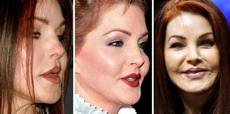 Priscilla Presley Before and After Plastic Surgery: in her youth and now