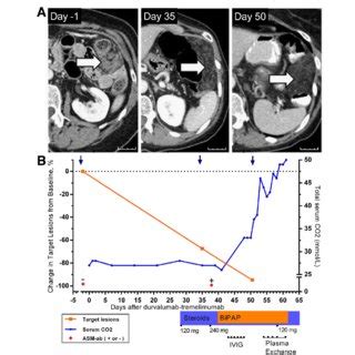 a Change in representative omental metastasis on CT scan after ...