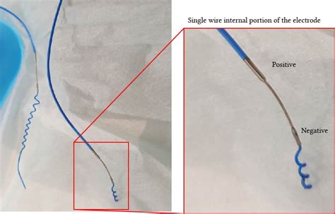 pacer wire placement - Wiring Diagram and Schematics