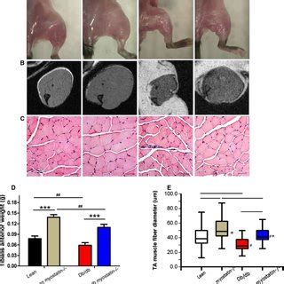 The myostatin gene significantly increased muscle mass in both lean and... | Download Scientific ...