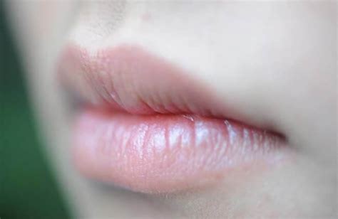 Lip discoloration: Meaning and treatment | Vinmec