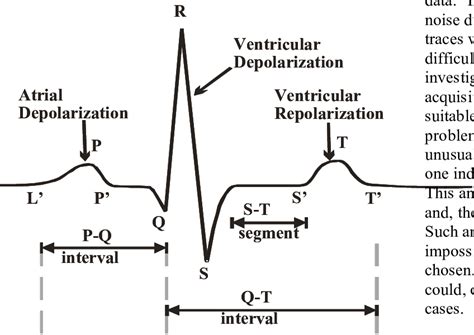 ECG Trace based upon Cardiac Physiology. L' and P' indicate the start ...