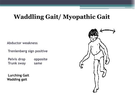 Gait abnormalities presentation