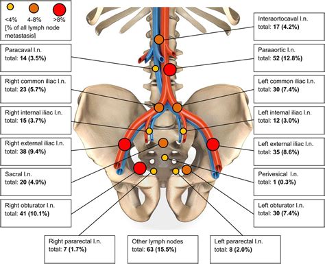 Lymph Node Involvement in Treatment-Naïve Prostate Cancer Patients ...