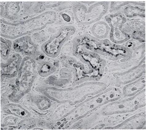 -Photomicrograph of kidney showing hemosiderin deposition within the... | Download Scientific ...