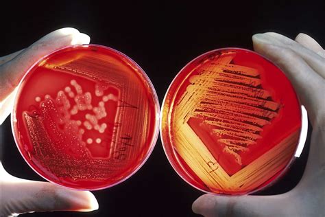 How To Streak a Bacterial Culture