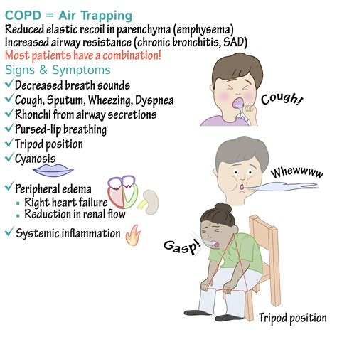 CHRONIC OBSTRUCTIVE PULMONARY DISEASE,WHAT TO KNOW?