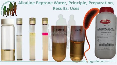 Alkaline Peptone Water Preparation, Composition, Principle,, 41% OFF