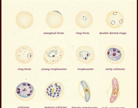 Plasmodium falciparum: morphology, life cycle, pathogenesis and clinical disease - Online ...