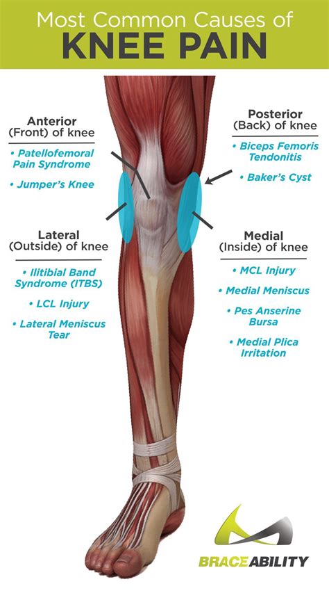 The Most Common Causes of Anterior, Posterior, Medial, and Lateral Knee Pain Muscle Anatomy ...