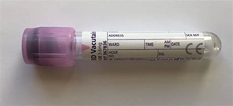 Thiopurine Methyl Transferase (TPMT) Exeter Clinical Laboratory International