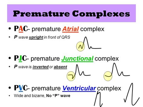 premature junctional contraction ecg - Tìm với Google | Icu nursing ...