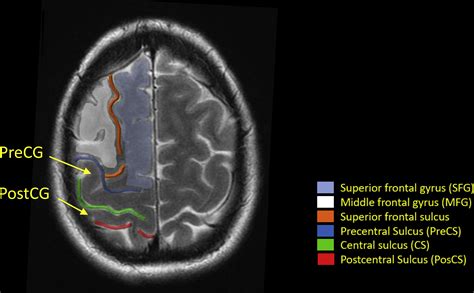 Functional Brain Anatomy | Radiology Key