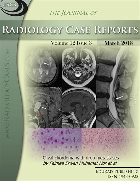 Archives | Free journal access | Radiology Journal