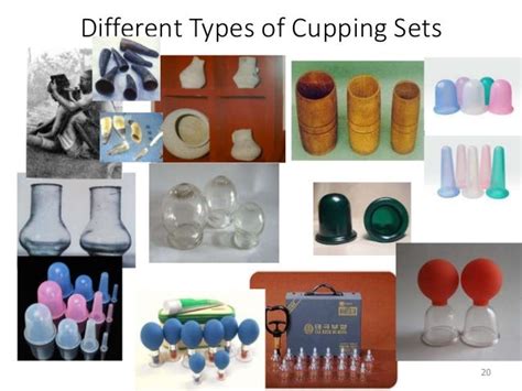 Cupping therapyforskindiseases