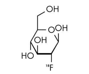 Fluorine-18 Fludeoxyglucose: PET Radiotracer | Open Medscience