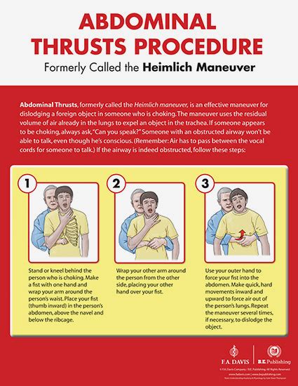 Abdominal Thrusts Procedure