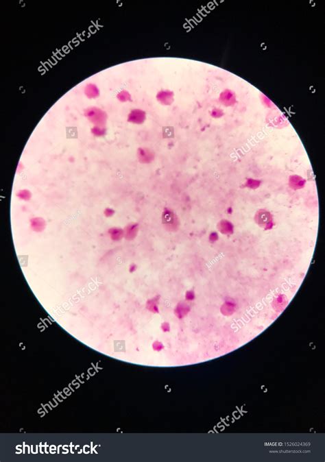 Trichomonas Vaginalis Trophozoite Stage Light Microscope Foto stock ...