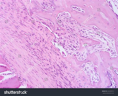 Histology Of Human Tissue Show Fibrous Cartilage Tissue And Connective ...