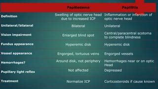 Optic Neuritis Vs Papilledema