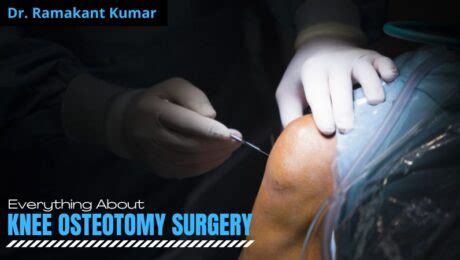 knee osteotomy before and after Archives - Dr. Ramakant Kumar