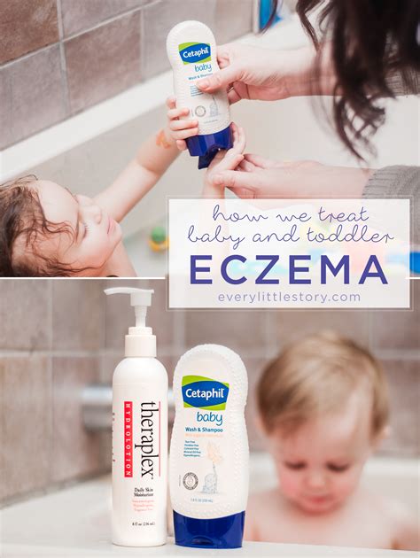 How We Treat Baby & Toddler Eczema | Toddler eczema, Eczema, Baby eczema