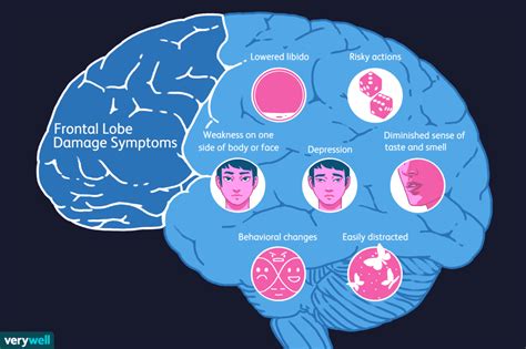 Frontal Lobe Damage Symptoms Cause Diagnosis Treatment | Free Nude Porn ...