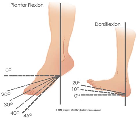 Pin on Fractured ankle