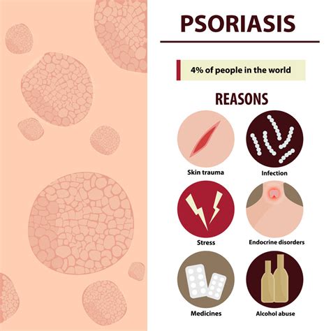 Psoriasis Vs Eczema: Let's Understand The Difference