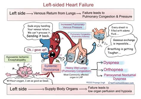 Heart Failure: Left sided VS Right sided - Creative Med Doses