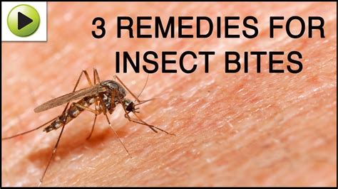 Insect Bites - Natural Ayurvedic Home Remedies - YouTube