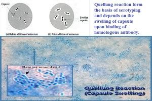 Quellung Reaction For Pneumococci