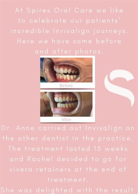 Invisalign Results | Spires Oral and Dermal Care