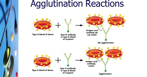 Lecture Notes in Medical Technology: Lecture #2: ANTIGEN-ANTIBODY ...