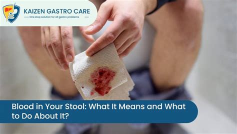 Blood in Your Stool: What It Means and What to Do About It- Kaizen Gastro Care