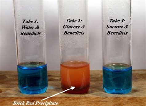 Benedict's Test: Principle, Requirements, Procedure and Result ...