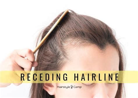 Details more than 122 female receding hairline hairstyles - tnbvietnam.edu.vn