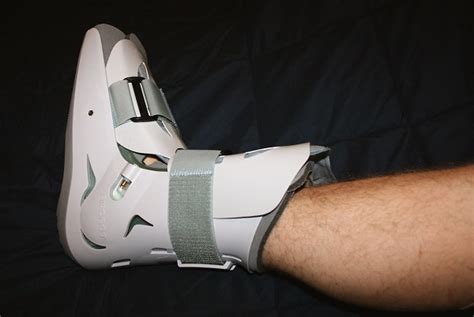 How Long to Wear Air Cast for Sprained Ankle | Ten Reviewed