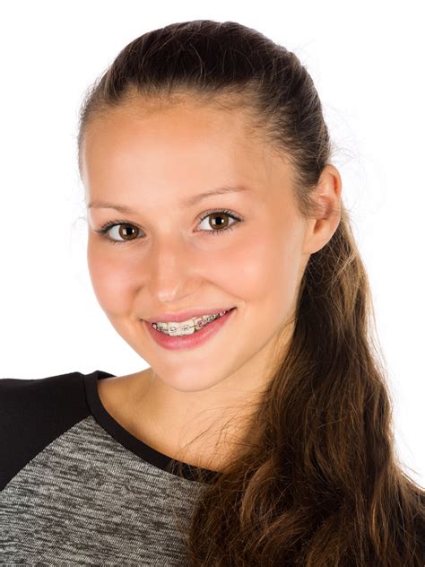 Woman With Braces Free Stock Photo - Public Domain Pictures