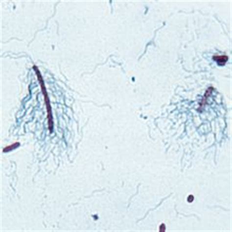 Erwinia carotovora (Pectobacterium carotovora), Living, Pathogen, Tube | Carolina Biological Supply