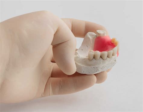 Can I Repair or Reline My Own Dentures? - The Denture and Implant Centre