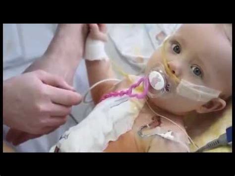 Chernobyl Mutations in Humans | Children of Chernobyl - YouTube