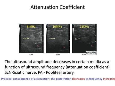 PPT - Ultrasound Imaging (Basics) PowerPoint Presentation, free ...