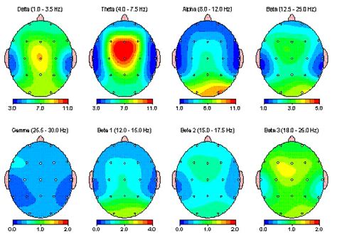 QEEG - Brain Wellness and Biofeedback Center