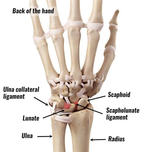 TFCC Tear - Sportsinjuryclinic.net | Hand surgery, Bones and muscles, Hand therapy