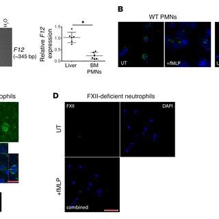 FXII signaling in neutrophils is a zymogen function. (A) WT neutrophils... | Download Scientific ...