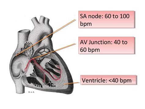 ECG Lecture: Sinus arrest, sinoatrial exit block, AV block and escape…